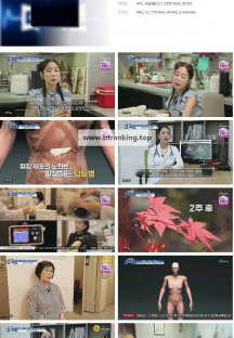 메디컬다큐 - 더 팩트.E29.241008.720p.H264-F1RST